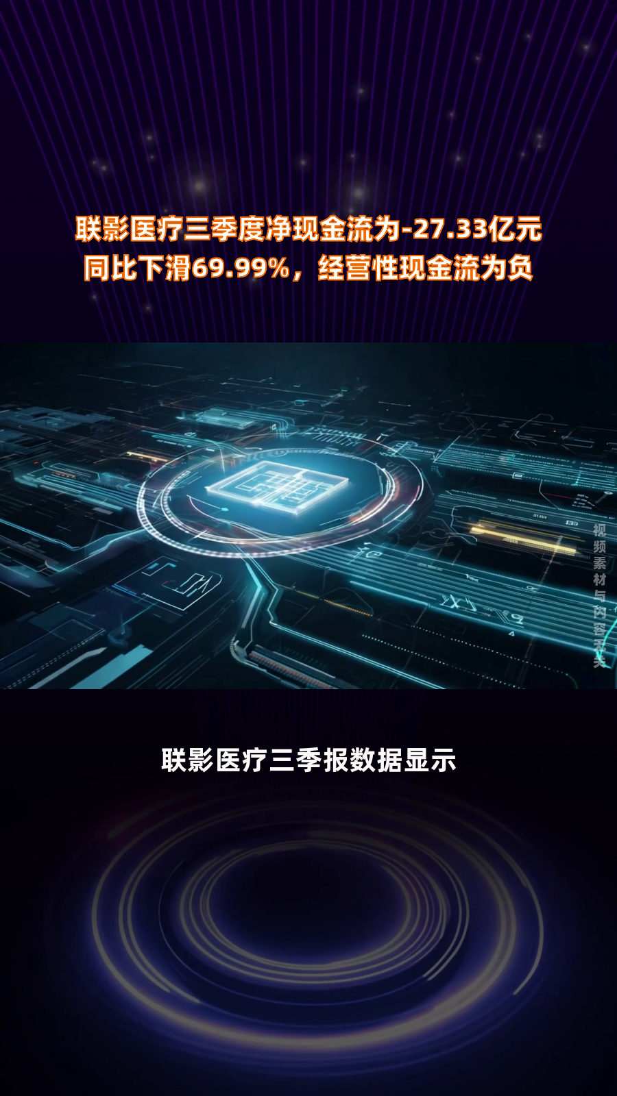 联影医疗：拟7000万元增资医疗AI企业联影智能